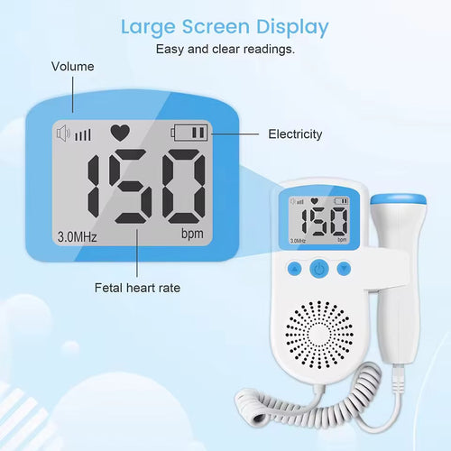 fetal doppler